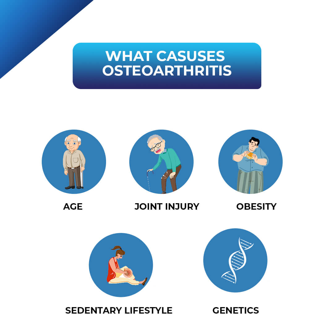 What Causes Osteoarthritis?