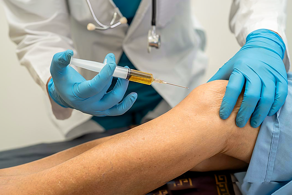 PRP Injections for Knee Pain